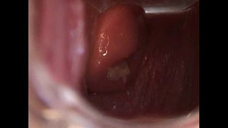 Avy Åbne Fisse med Speculum